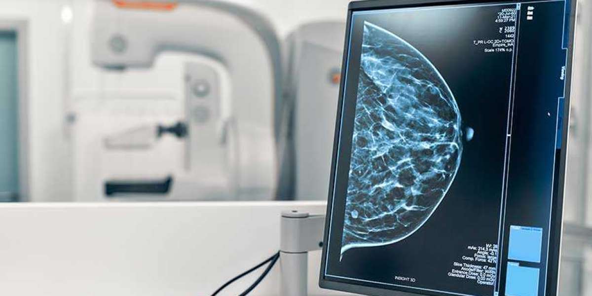 The Mammography System Market Revolution: Understanding the Market and Its Impact