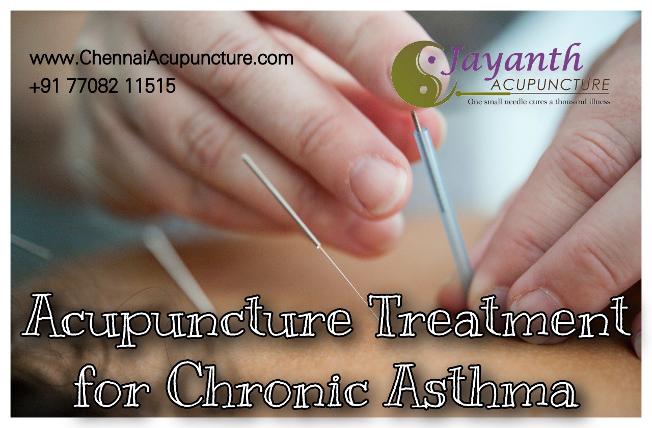 Acupuncture Treatment for Chronic Asthma |Best Acupuncture Treatment by Well Experienced Acupuncture Doctor in Chennai