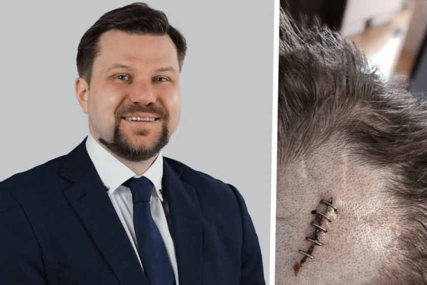 German AfD politician hospitalised after alleged attack in pub – Allah's Willing Executioners